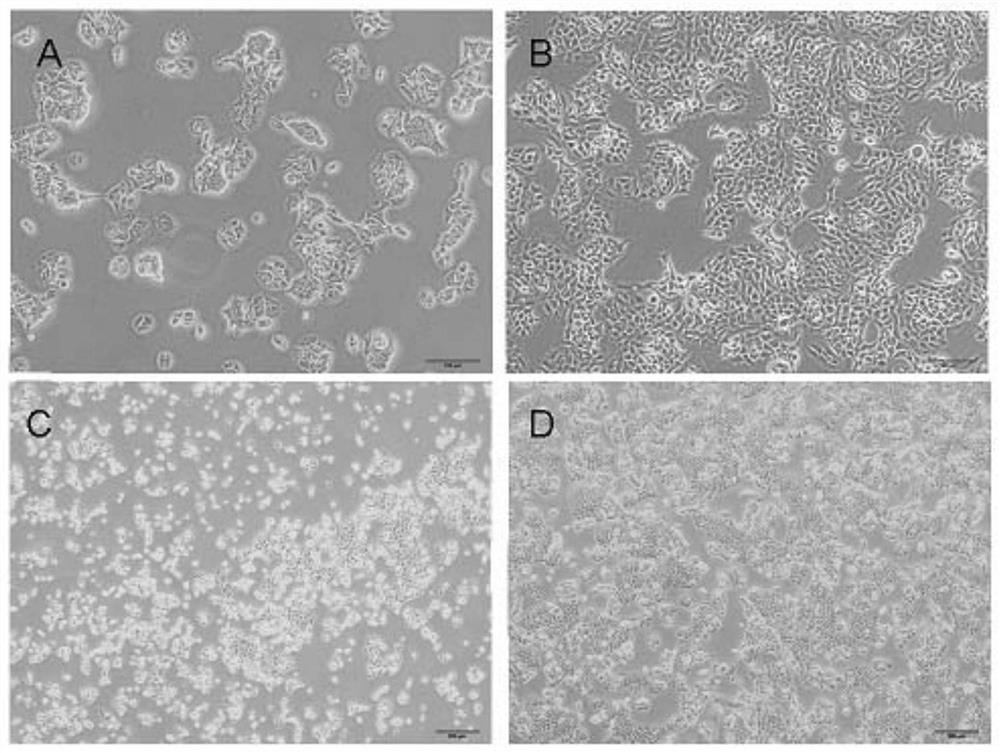 A method for establishing a three-dimensional skin model for anti-inflammatory and anti-allergic efficacy evaluation