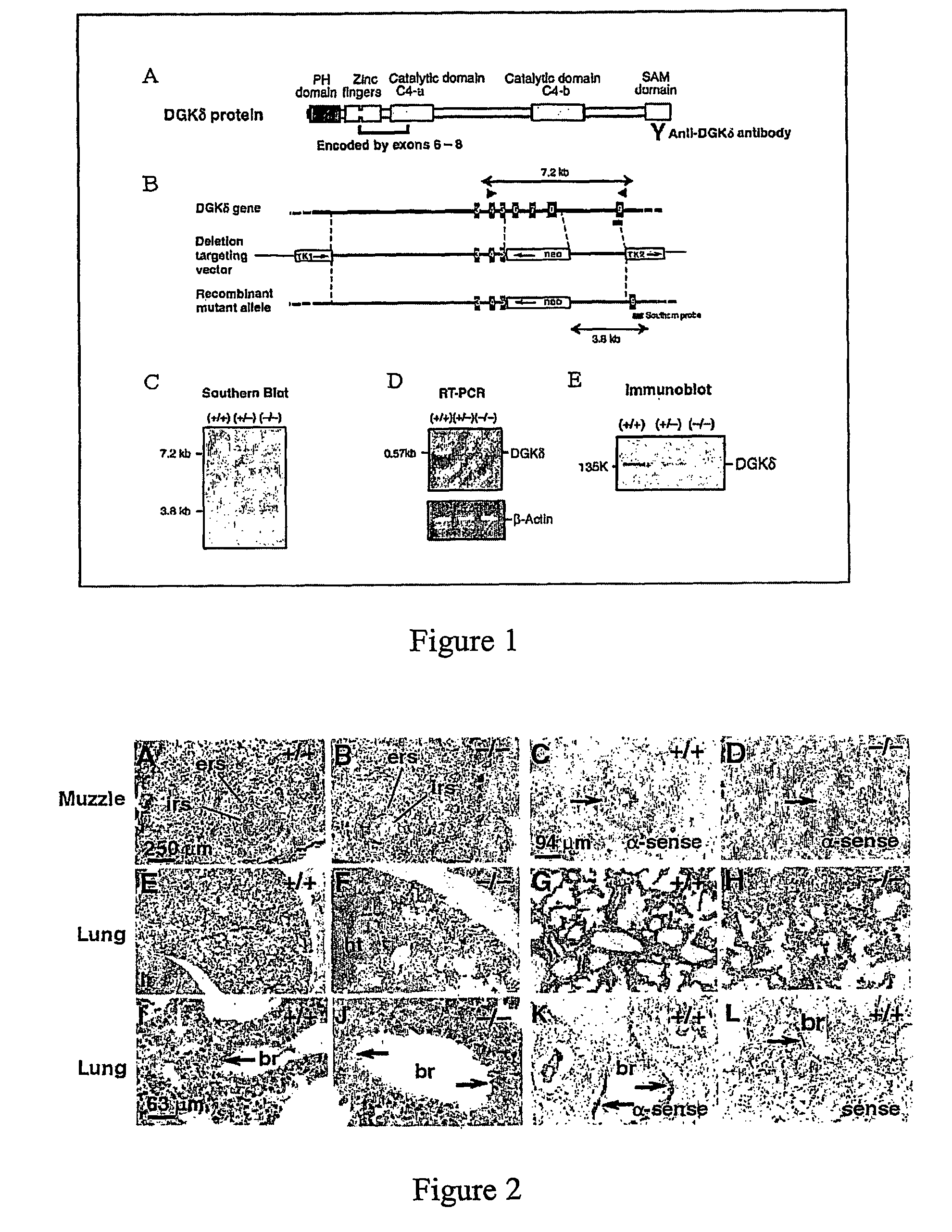 Method of screening for agents that regulate the shedding of membrane bound proteins and methods of use