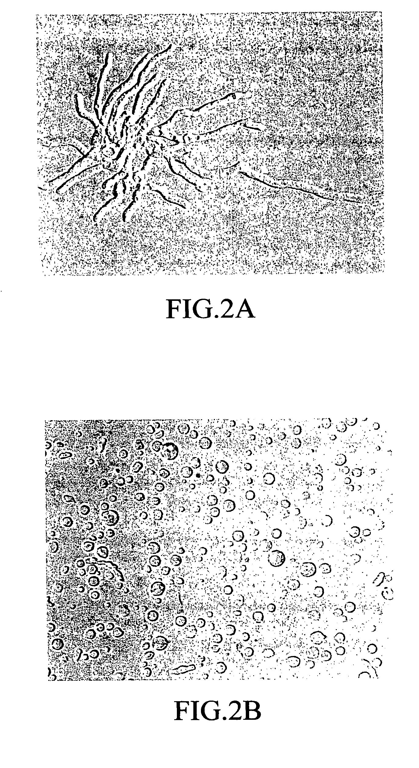 Fungal antigens and process for producing the same