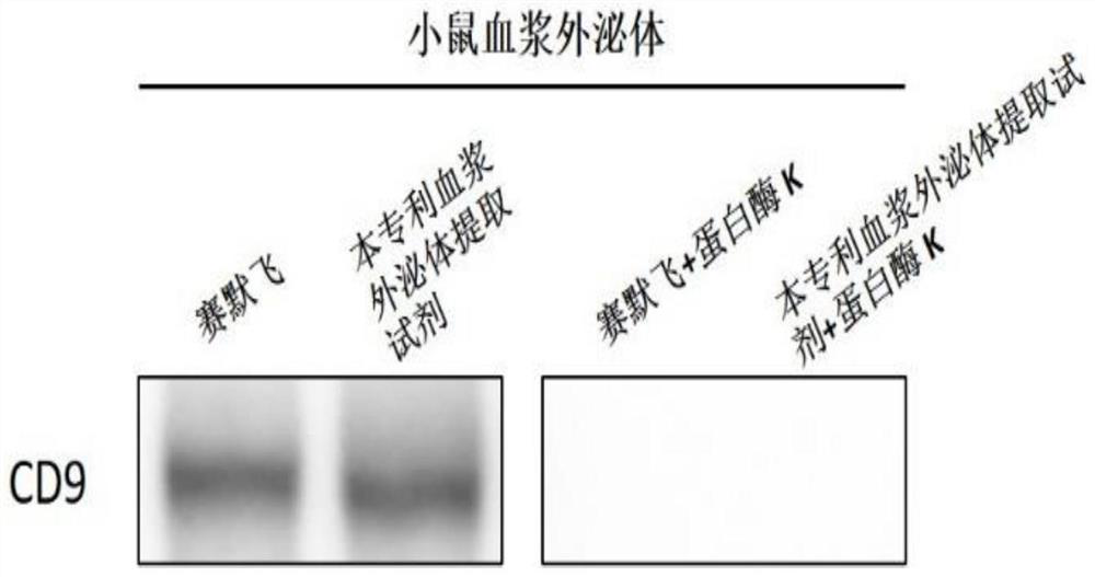 Plasma exosome extraction reagent, enrichment method, extraction kit and application thereof