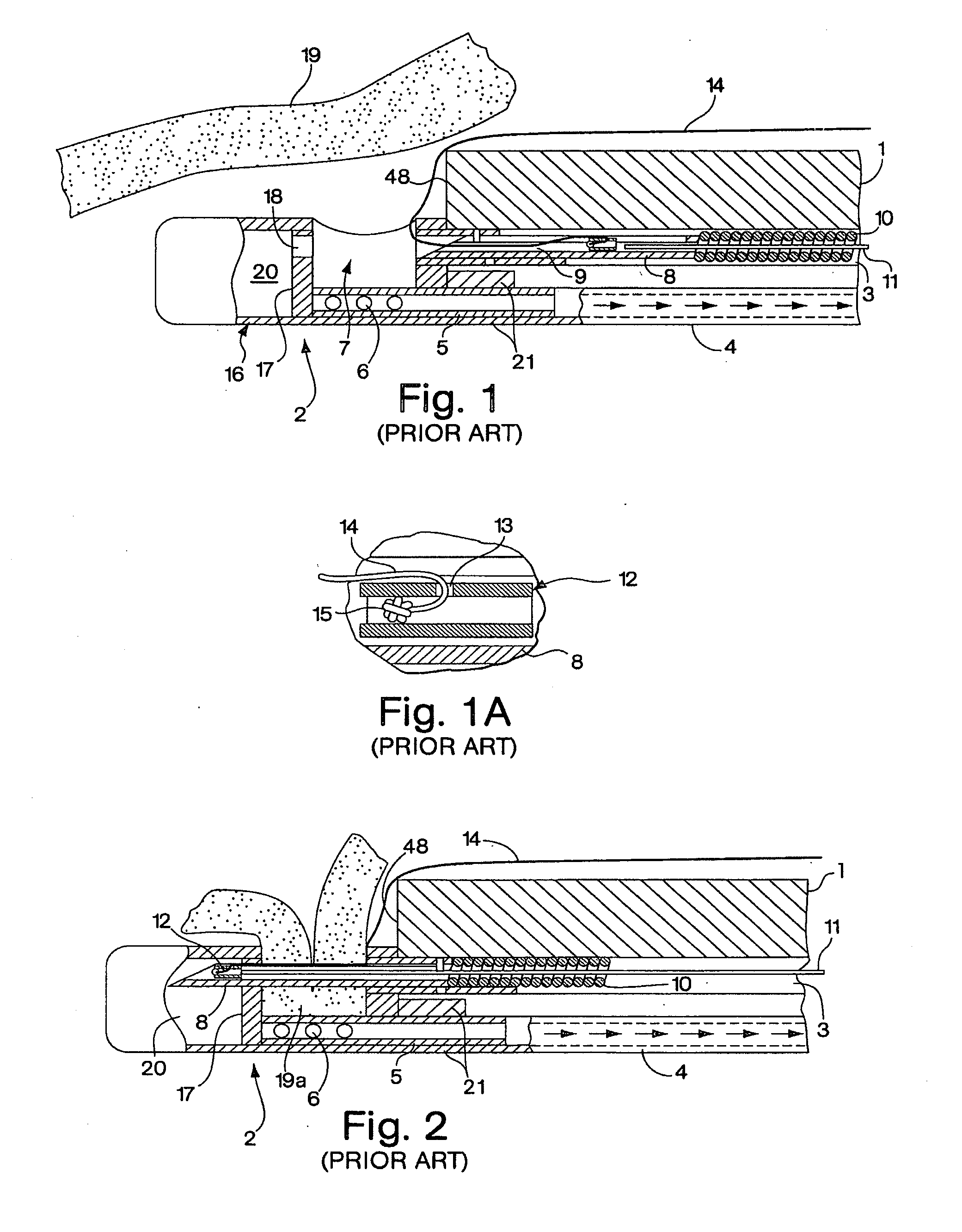 Tissue capturing devices