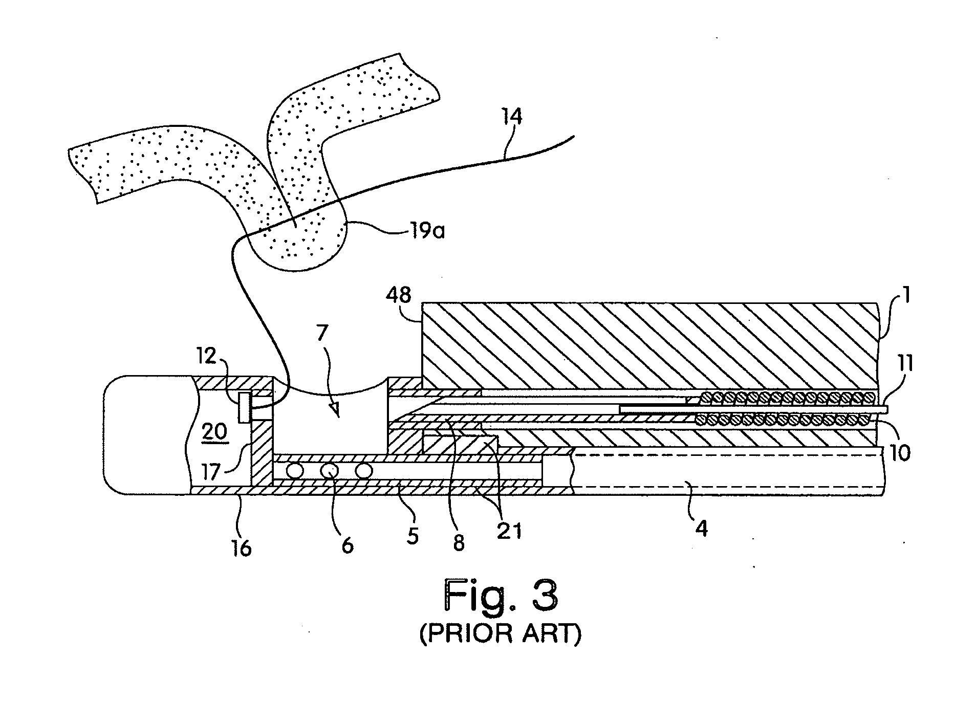 Tissue capturing devices