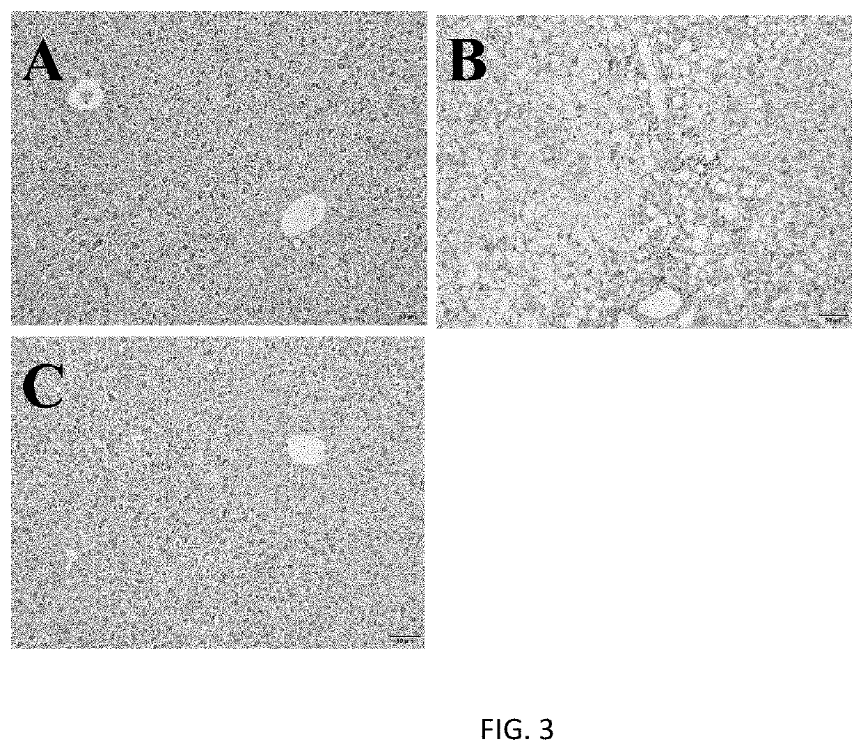 Compound for treatment or prevention of liver diseases