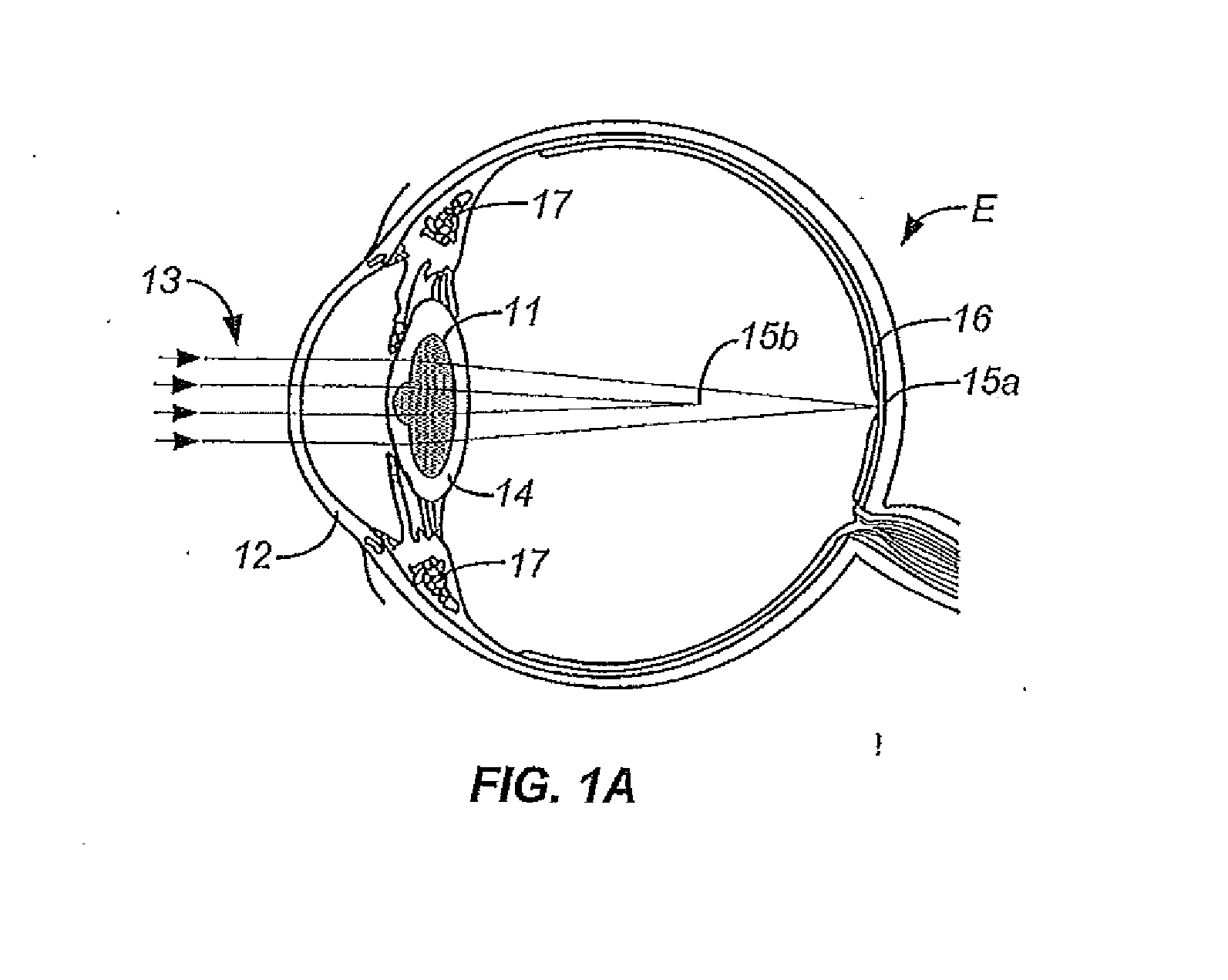 Single microstructure lens, systems and methods