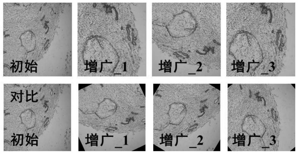 Breast tissue classification and identification method based on transfer learning