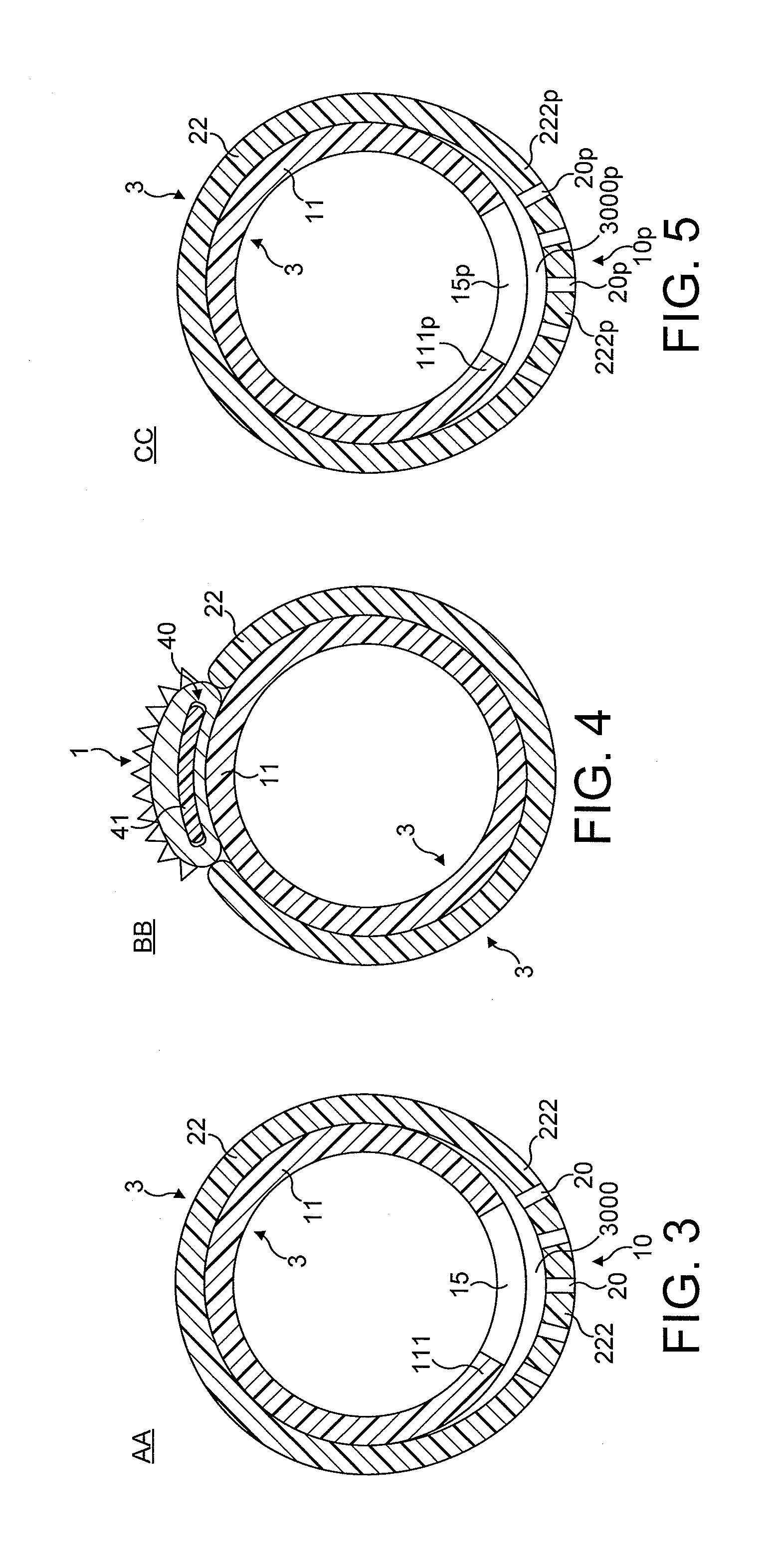 Rotational atherectomy device with fluid inflatable support elements and torque transmitting membrane