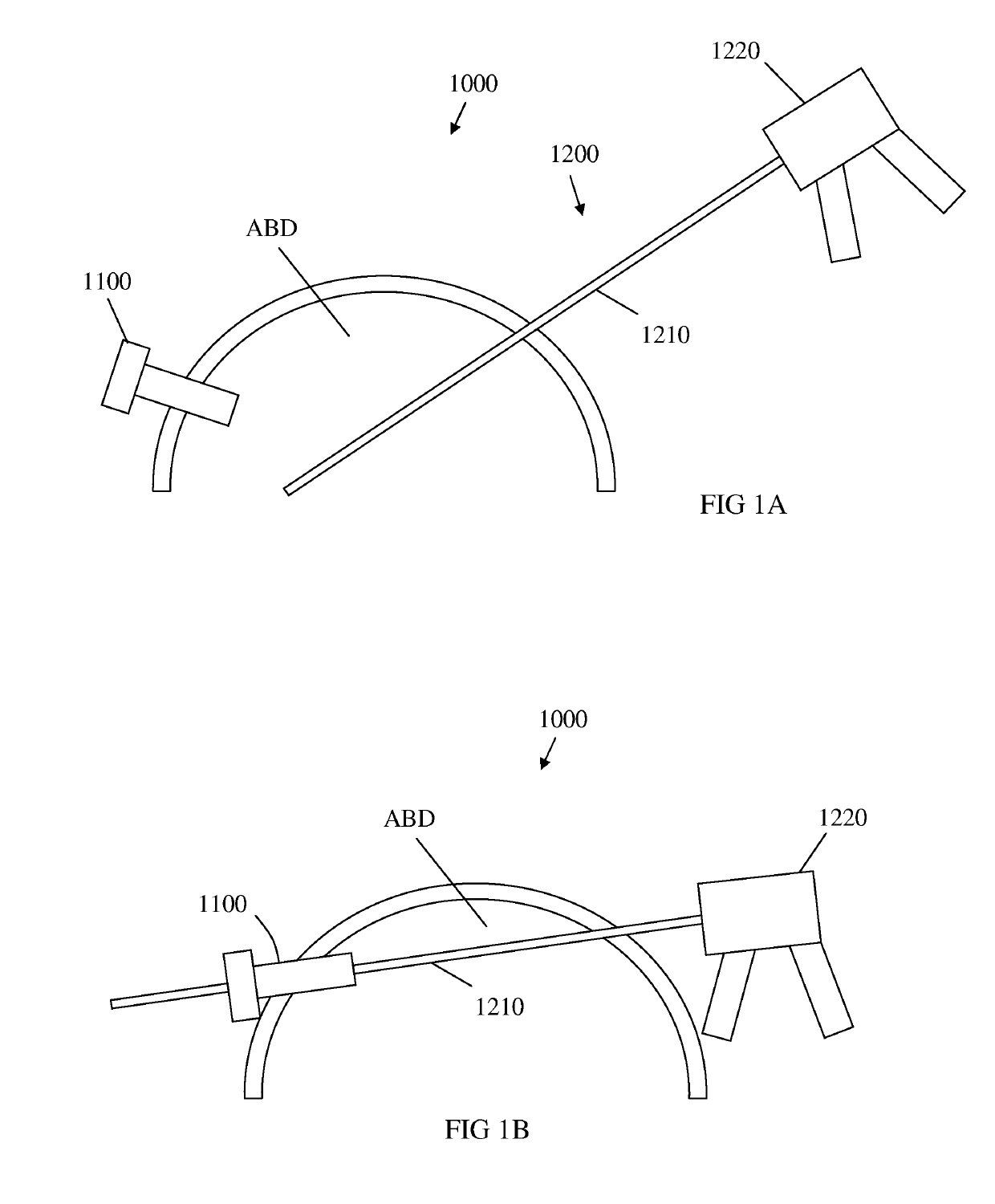 Micro laparoscopy devices and deployments thereof