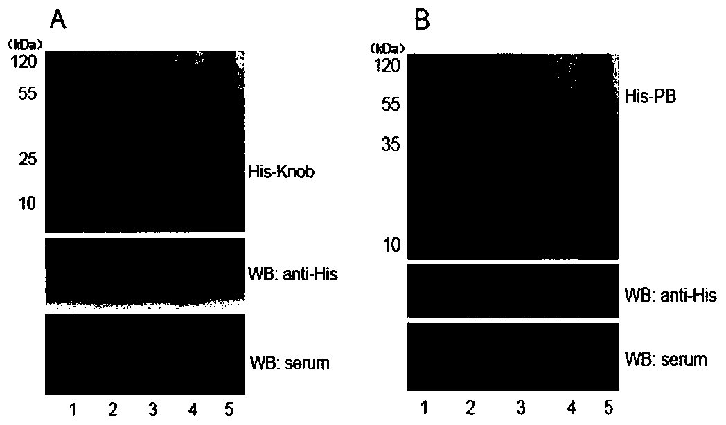 Canine adenovirus type-1 antibody ELISA detection kit and application thereof