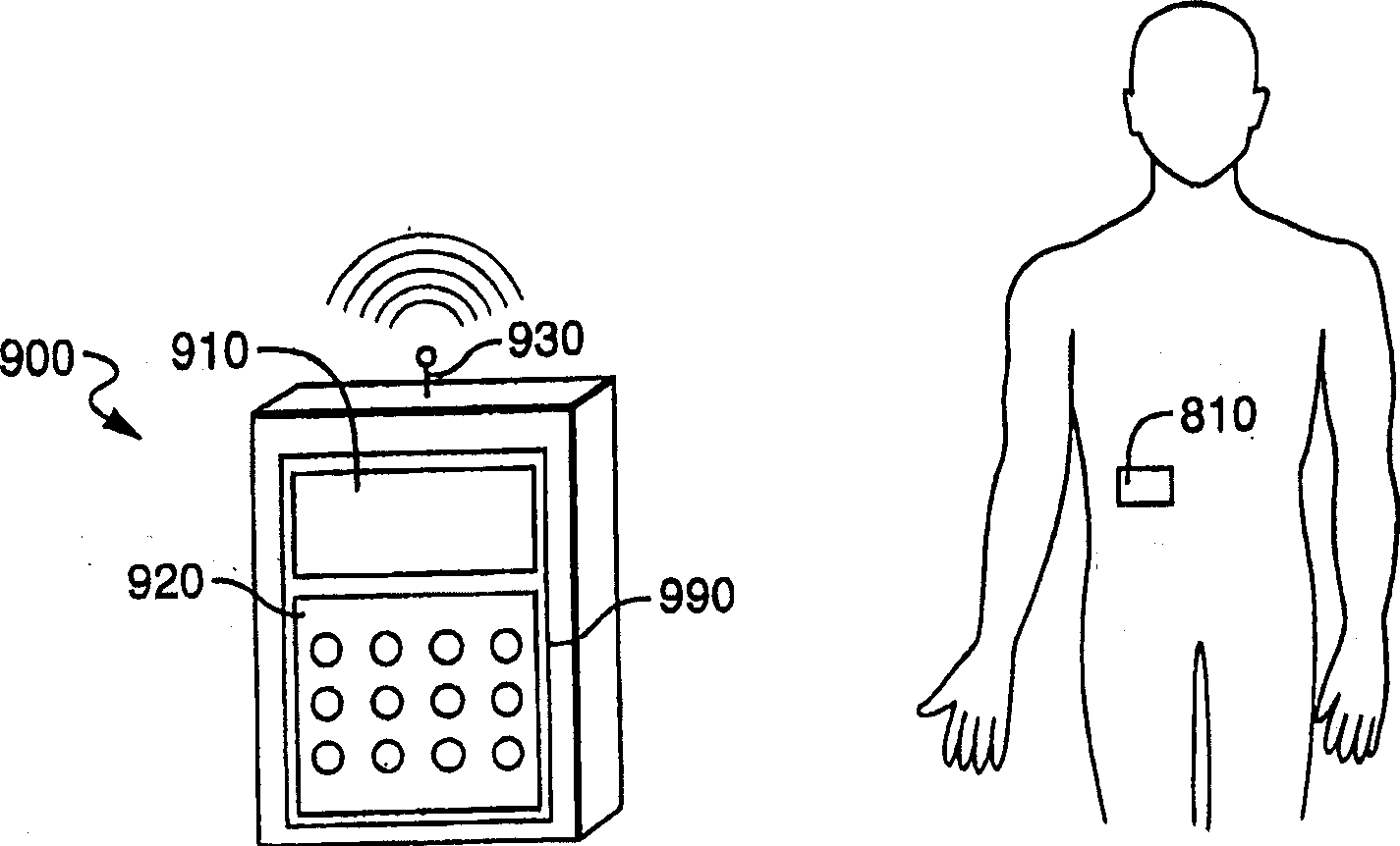 Self-contained, automatic transcutaneous physiologic sensing system