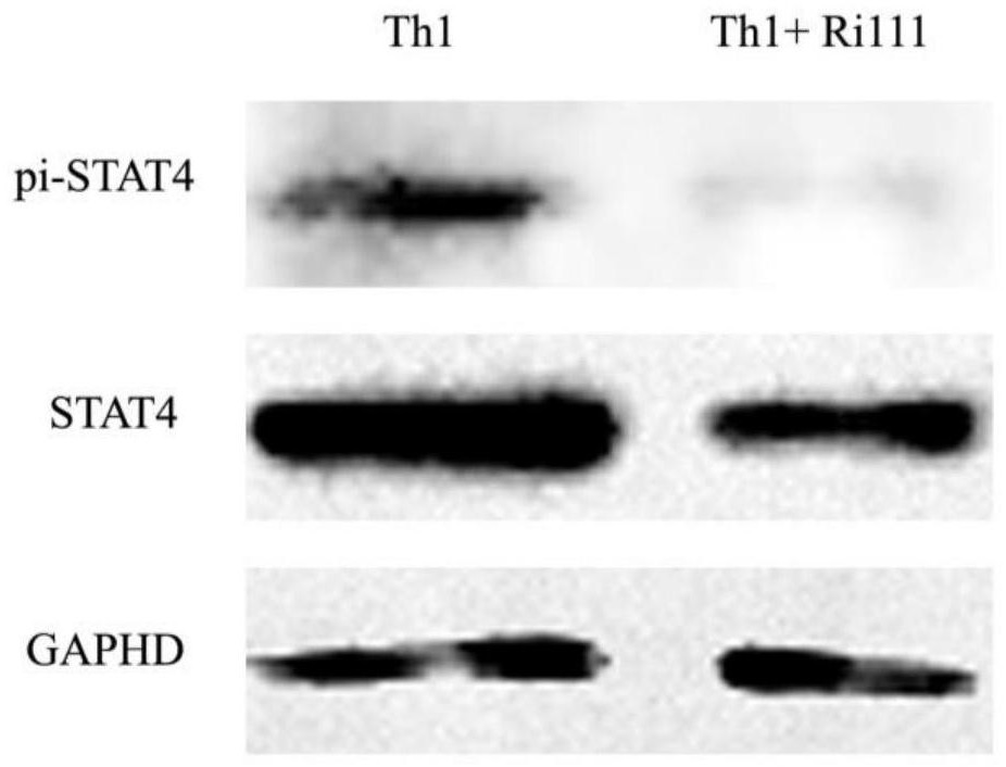 Application of artificially constructed antisense nucleotide fragment Ri111 in Th1 cell polarization