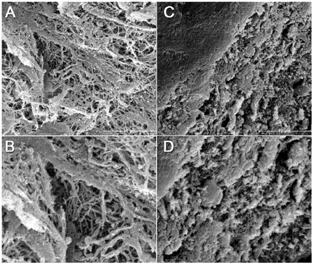 Autologous biomedical fibrin glue preparation for plugging digestive tract fistula as well as preparation method and application of autologous biomedical fibrin glue preparation
