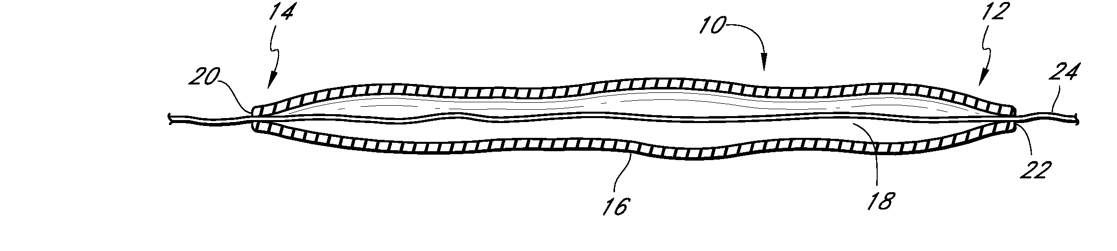 Methods of forming a multilayer tissue implant to create an accordion effect on the outer layer