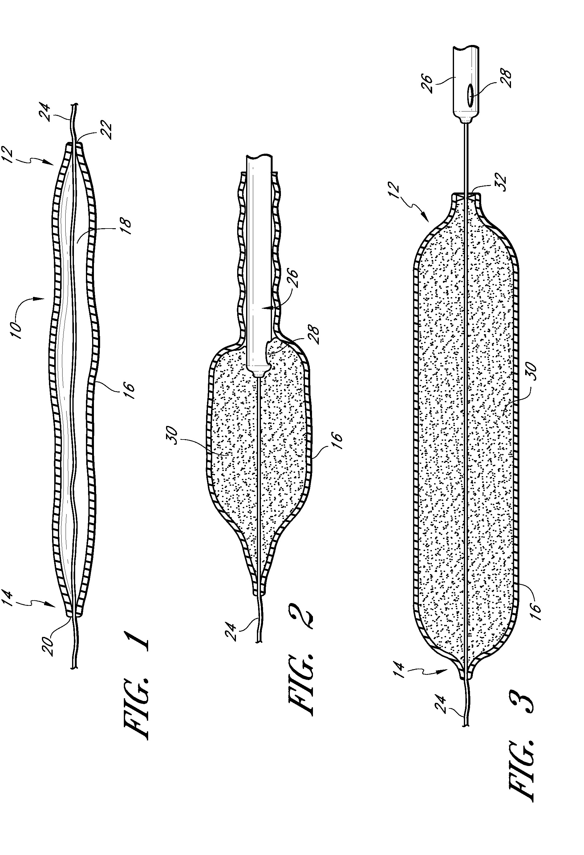 Methods of forming a multilayer tissue implant to create an accordion effect on the outer layer