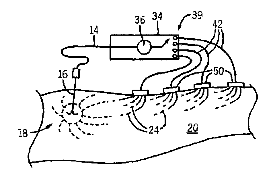 Radiofrequency ablation with independently controllable ground pad conductors