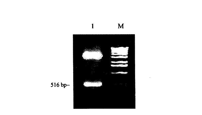 Deoxyhydroxylputrescinelysine synthase code gene and antisense base sequences thereof