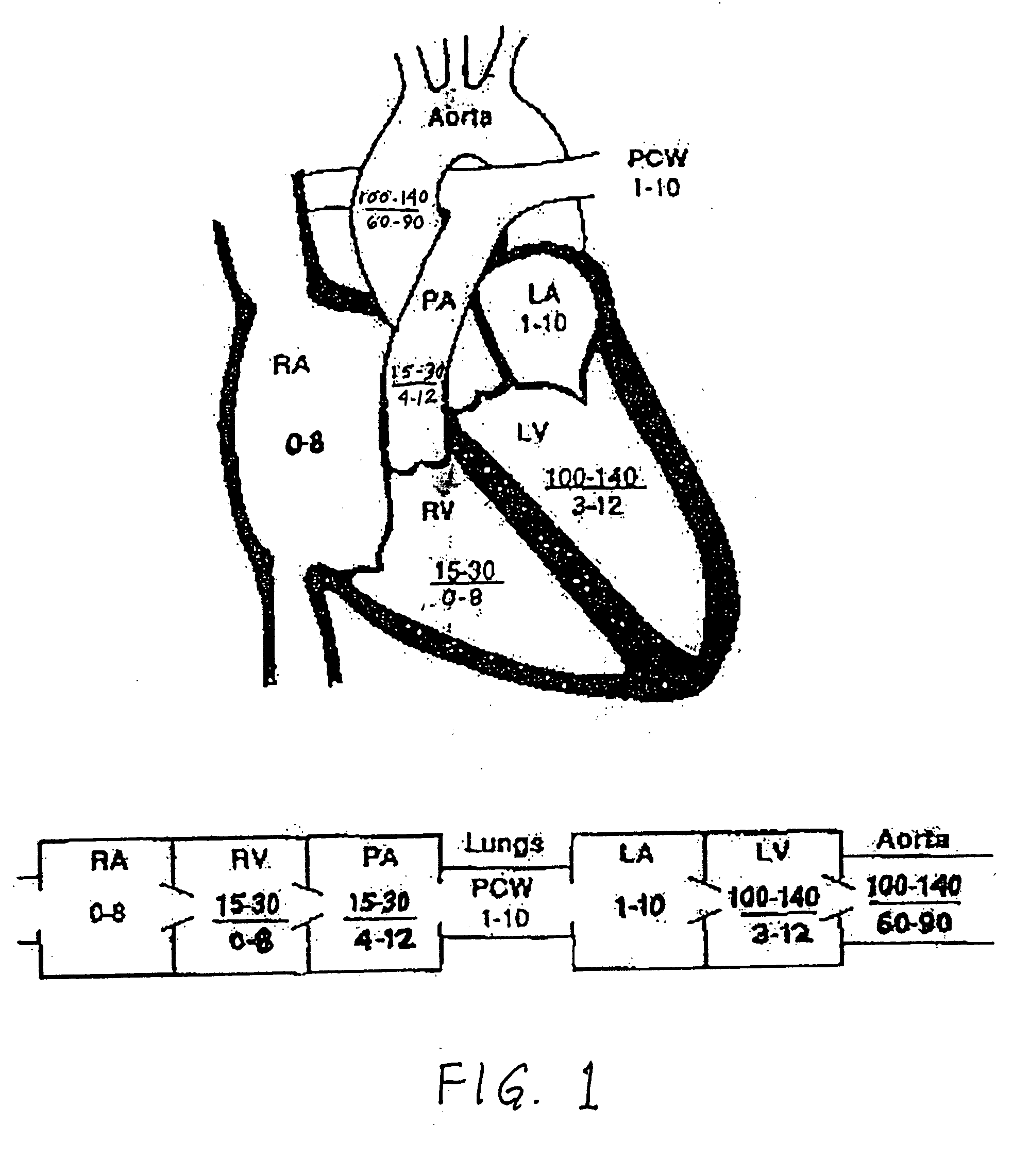 Method and apparatus for treating heart failure