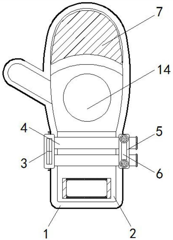 A kind of preparation method of children's infusion fixation plate for anesthesiology department