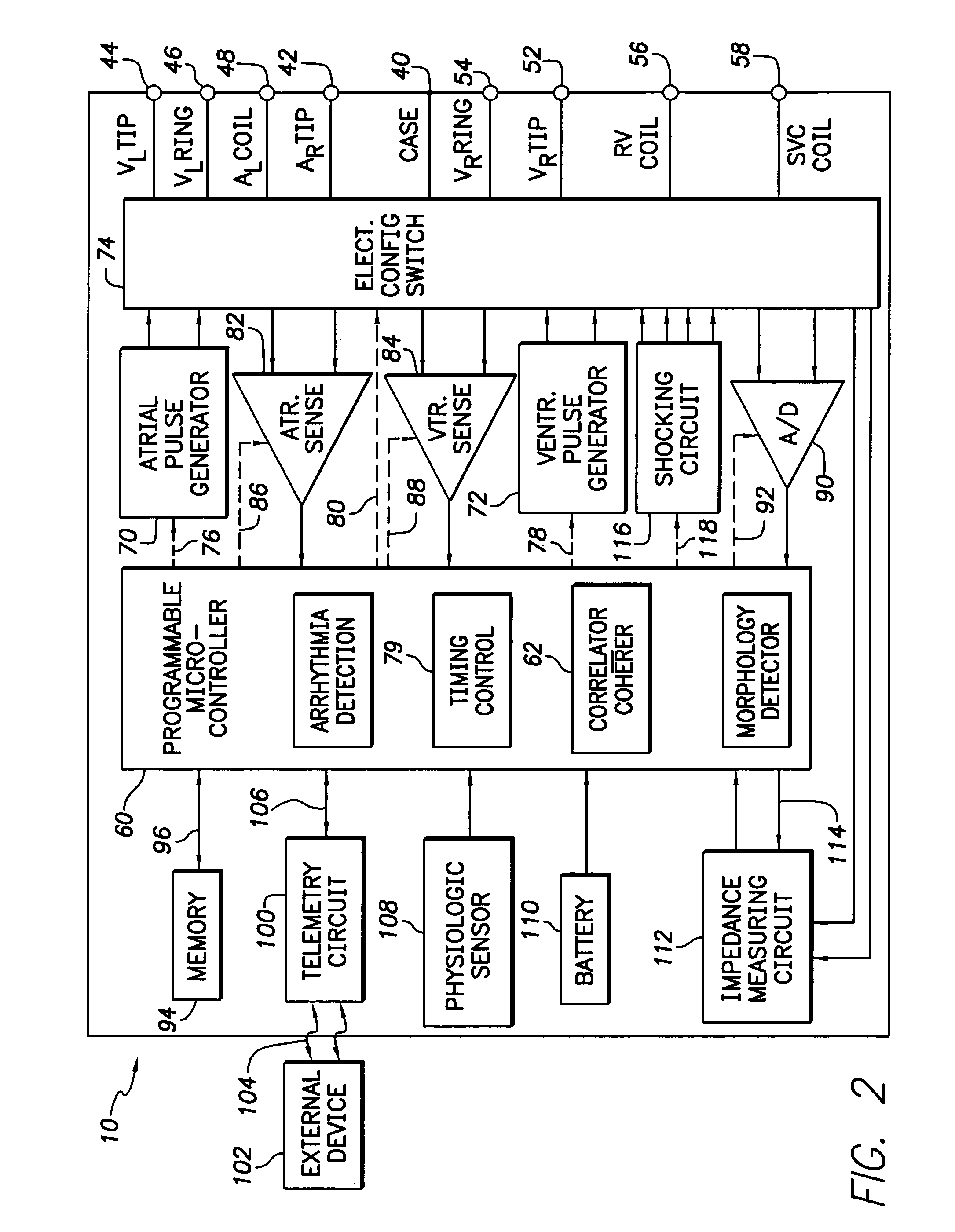 Implantable cardiac stimulation device and method that discriminates between and treats ventricular tachycardia and ventricular fibrillation