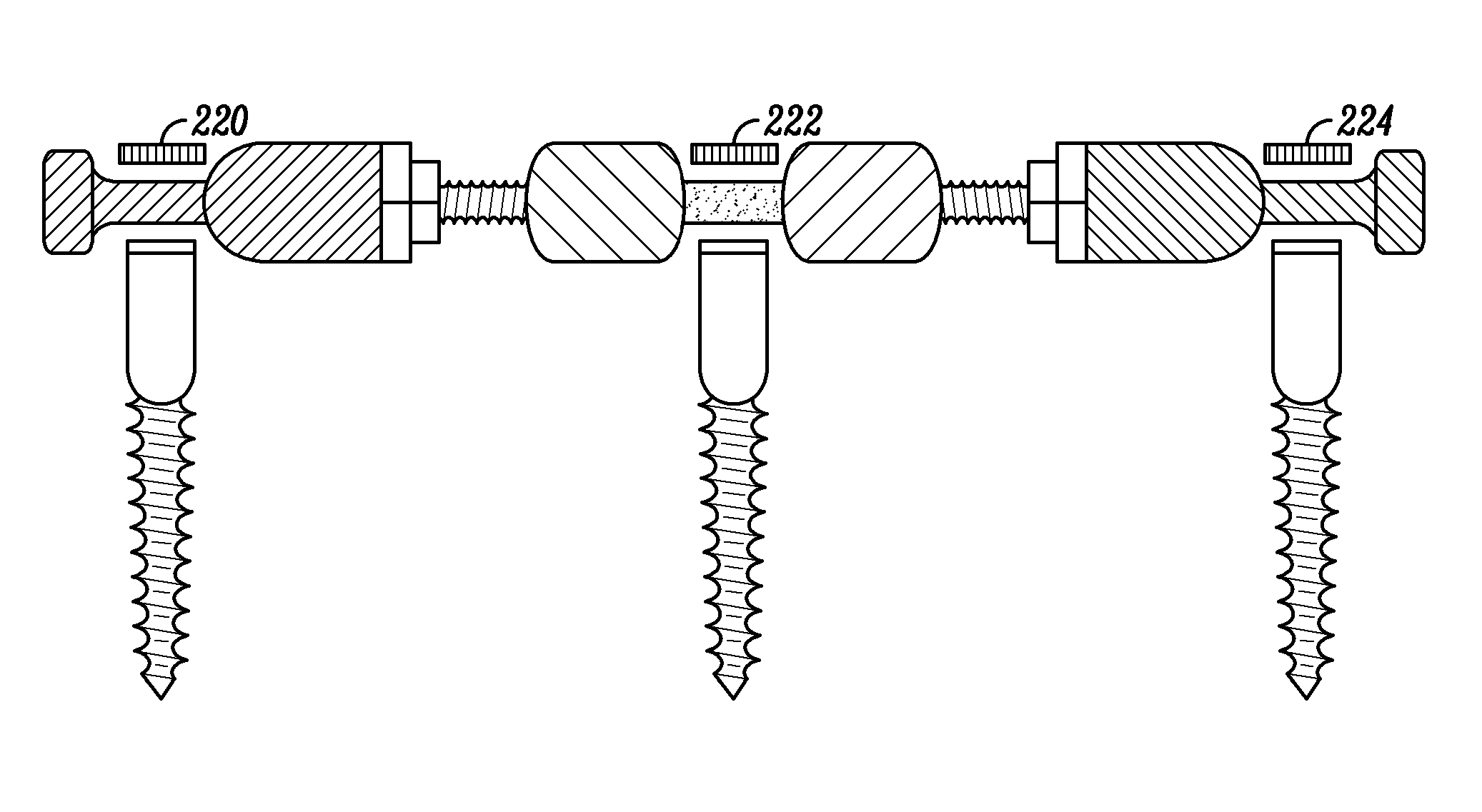 Methods and Apparatus for Treating Spinal Stenosis