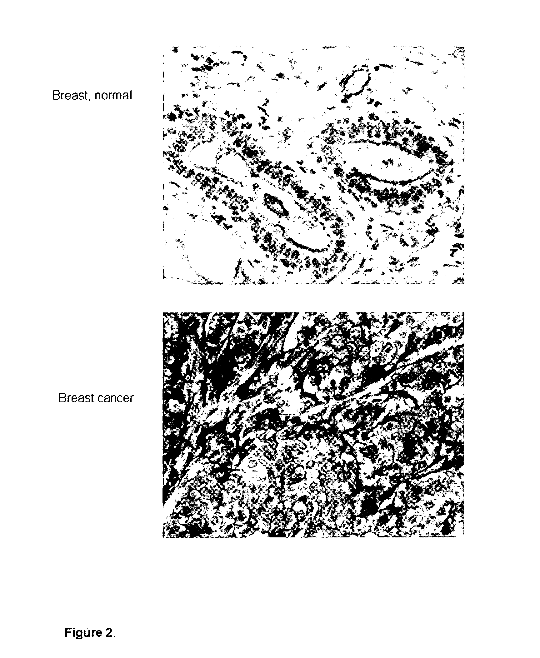 Tumor Marker and Methods of Use Thereof