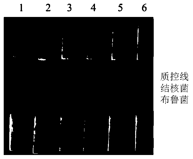Nucleic acid double detection test strip for brucella and mycobacterium tuberculosis