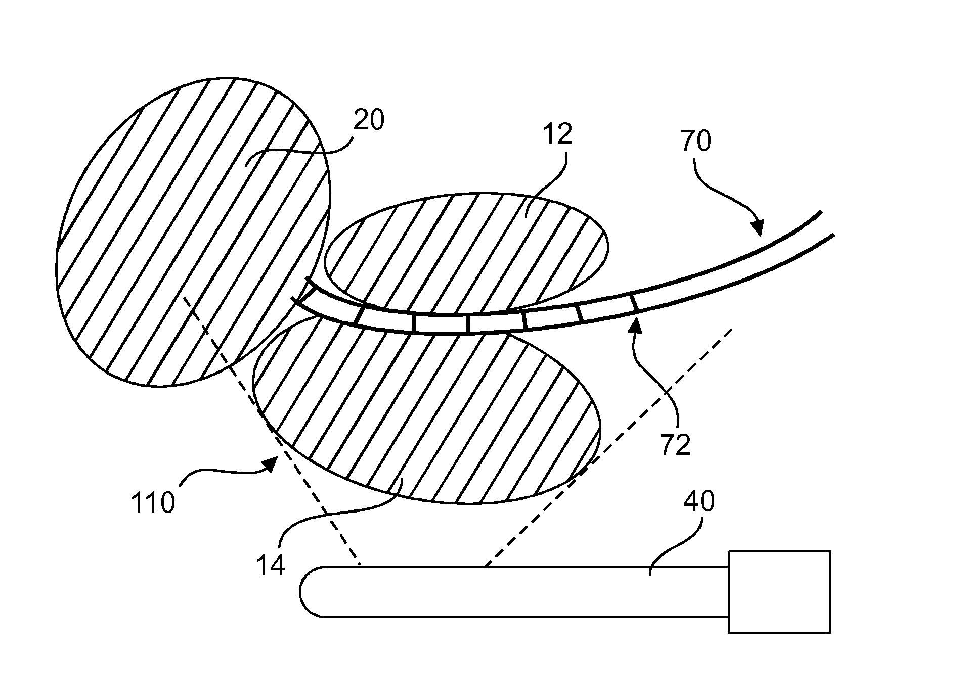 Method and system for localizing body structures