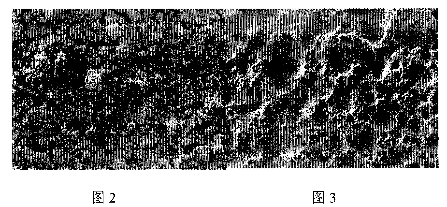 Treatment method of metal printing plate surface for offset-printing plate-making