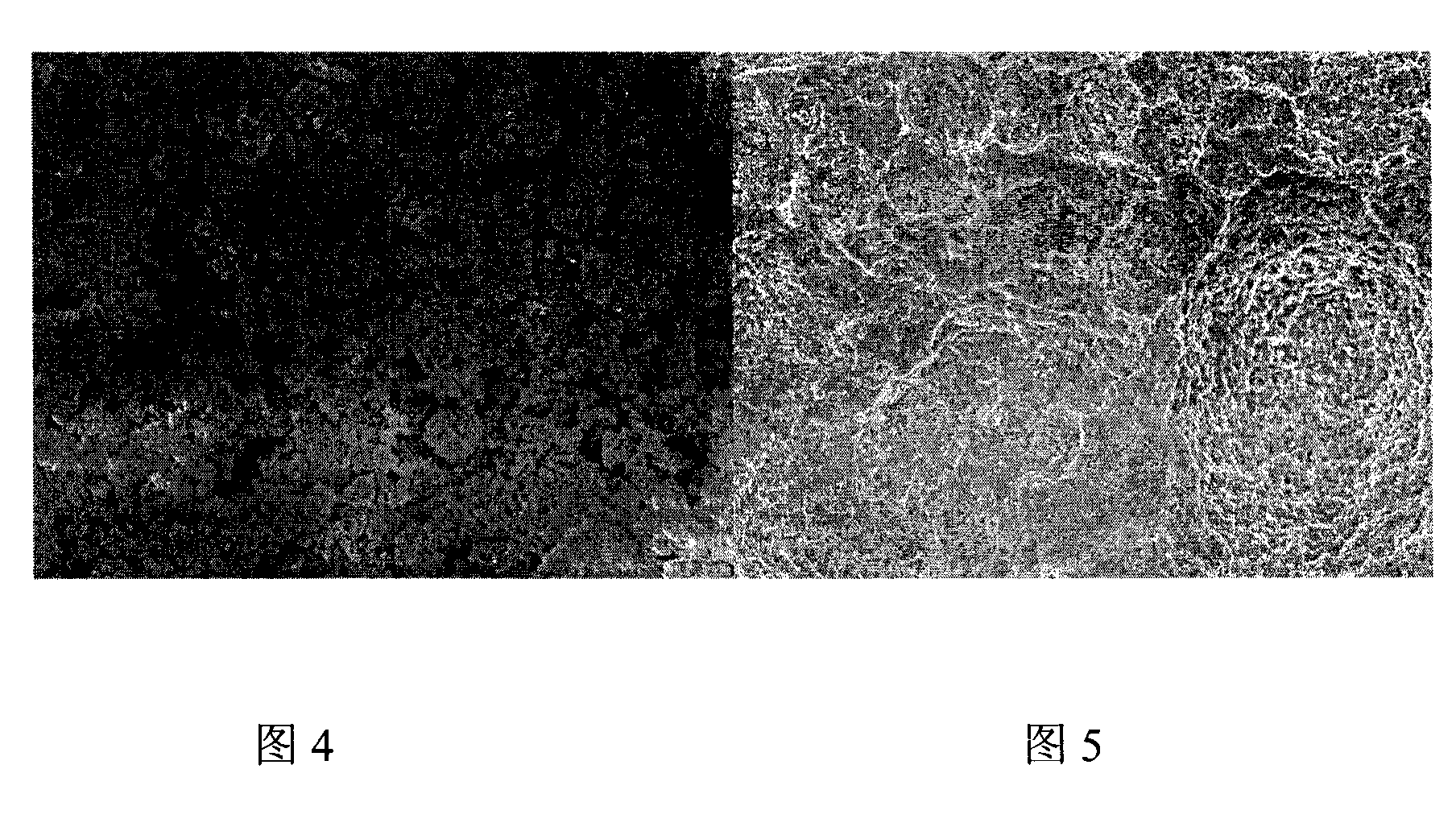 Treatment method of metal printing plate surface for offset-printing plate-making