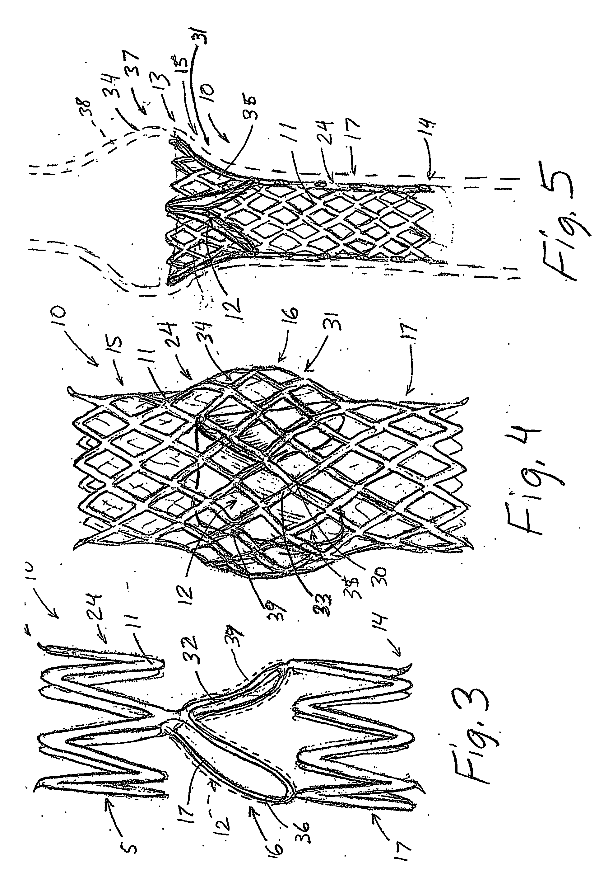 Artificial Valve Prosthesis with Improved Flow Dynamics