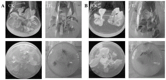 Soybean eIF5A gene subtypes and genetic engineering bacteria, and applications thereof