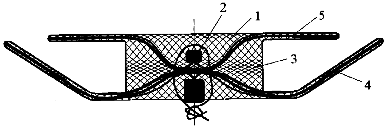 Bronchial fistula closure device