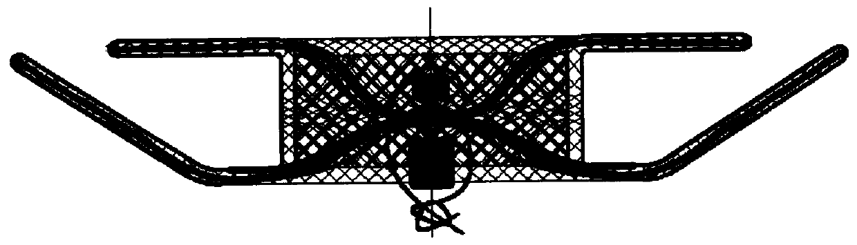 Bronchial fistula closure device