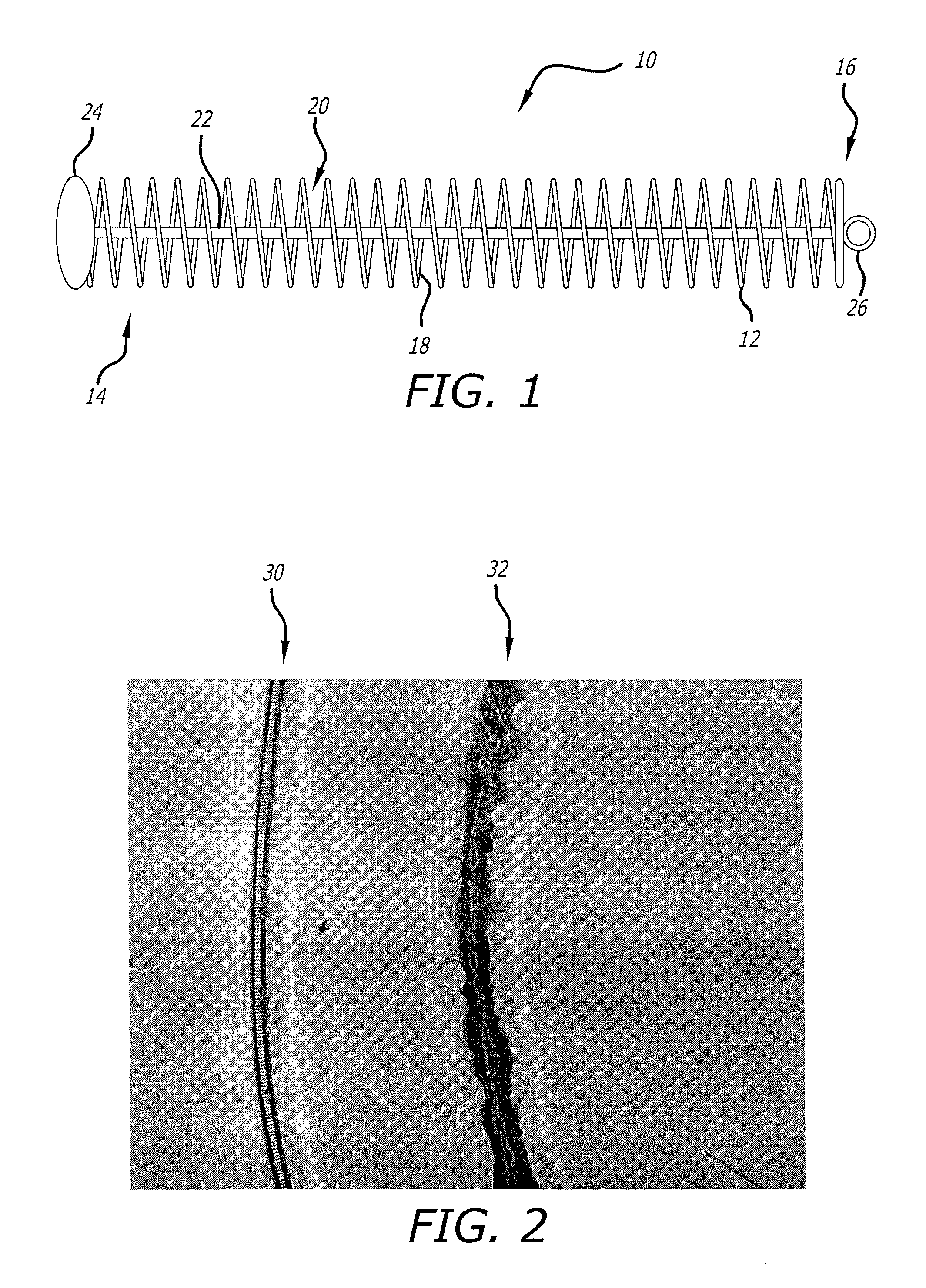 Multistrand coil for interventional therapy