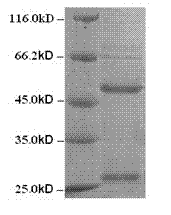 Preparation and application of dmt monoclonal antibody immunoaffinity column supported by chitosan