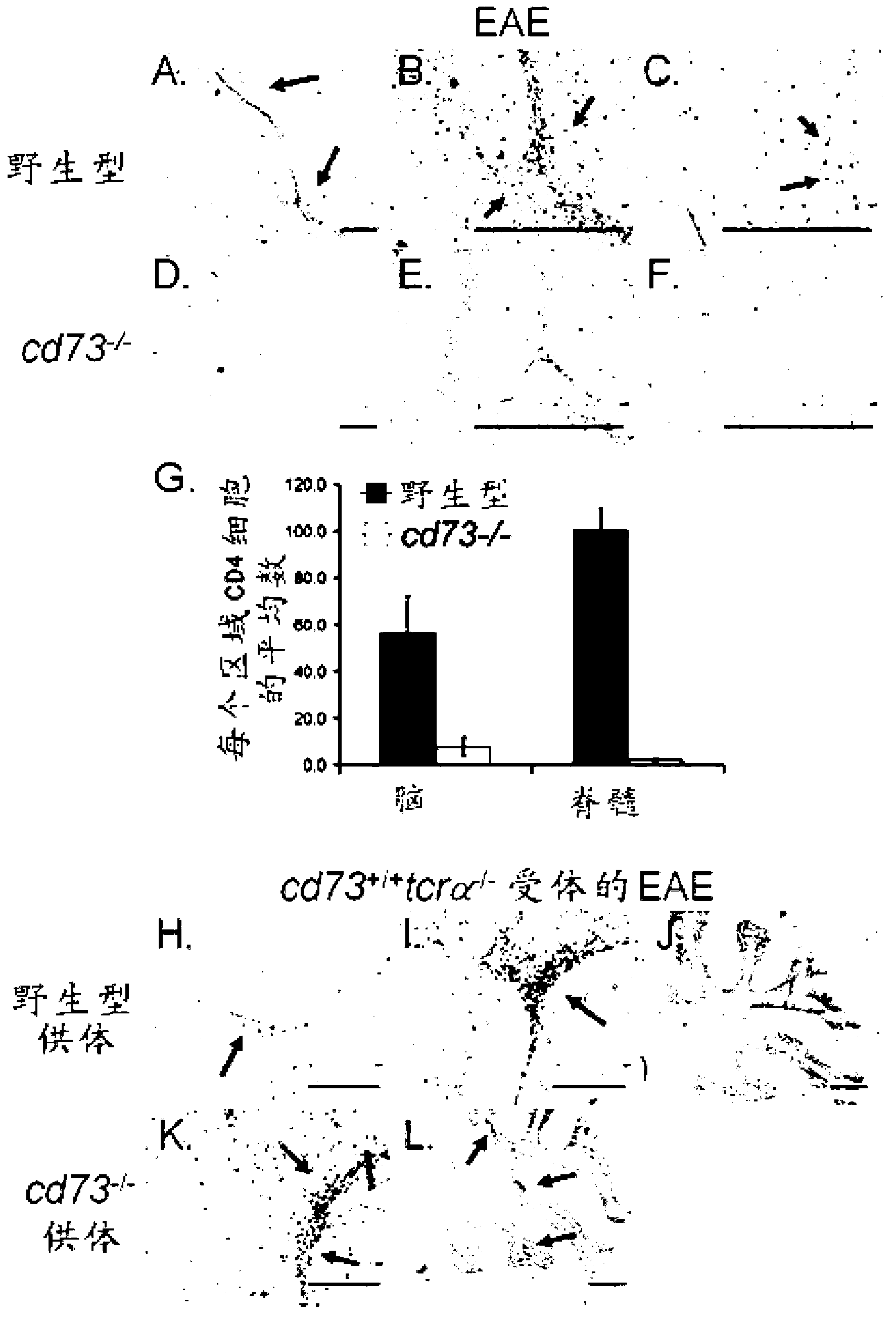 Use of adenosine receptor signaling to modulate permeability of blood-rain barrier