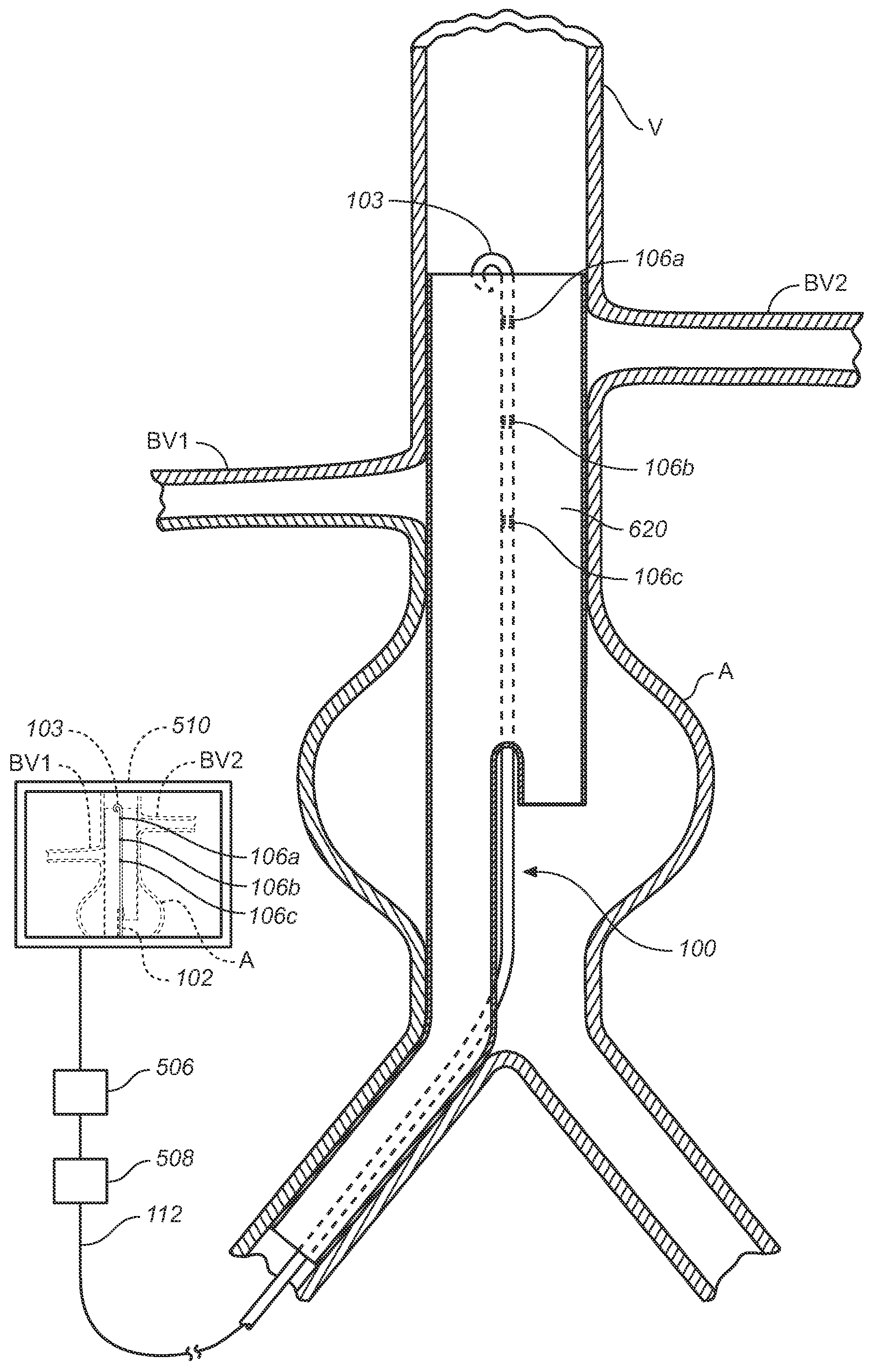 Vessel Position and Configuration Imaging Apparatus and Methods