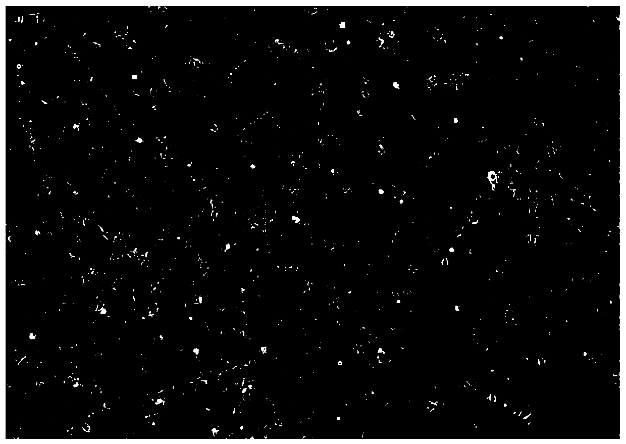 In-vitro establishing method of acipenser ruthenus theca cell line and reagents applied to acipenser ruthenus theca cell line preparation