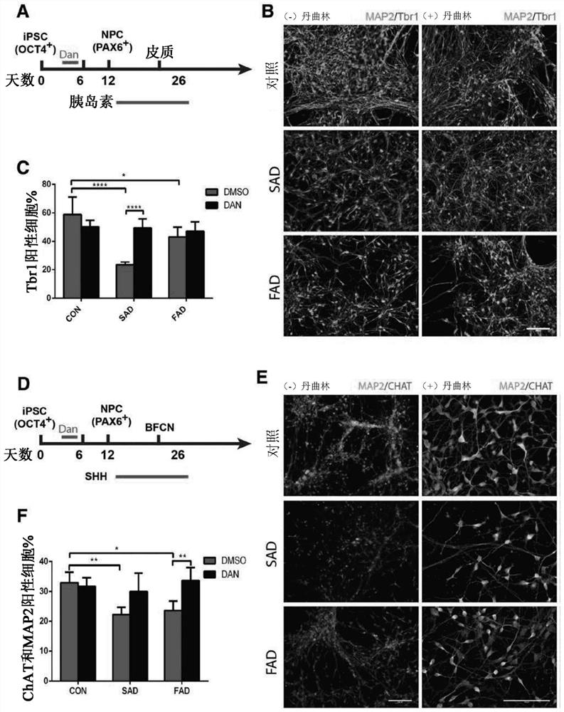 Intranasal Dantroline Administration For The Treatment Of Alzheimer Disease