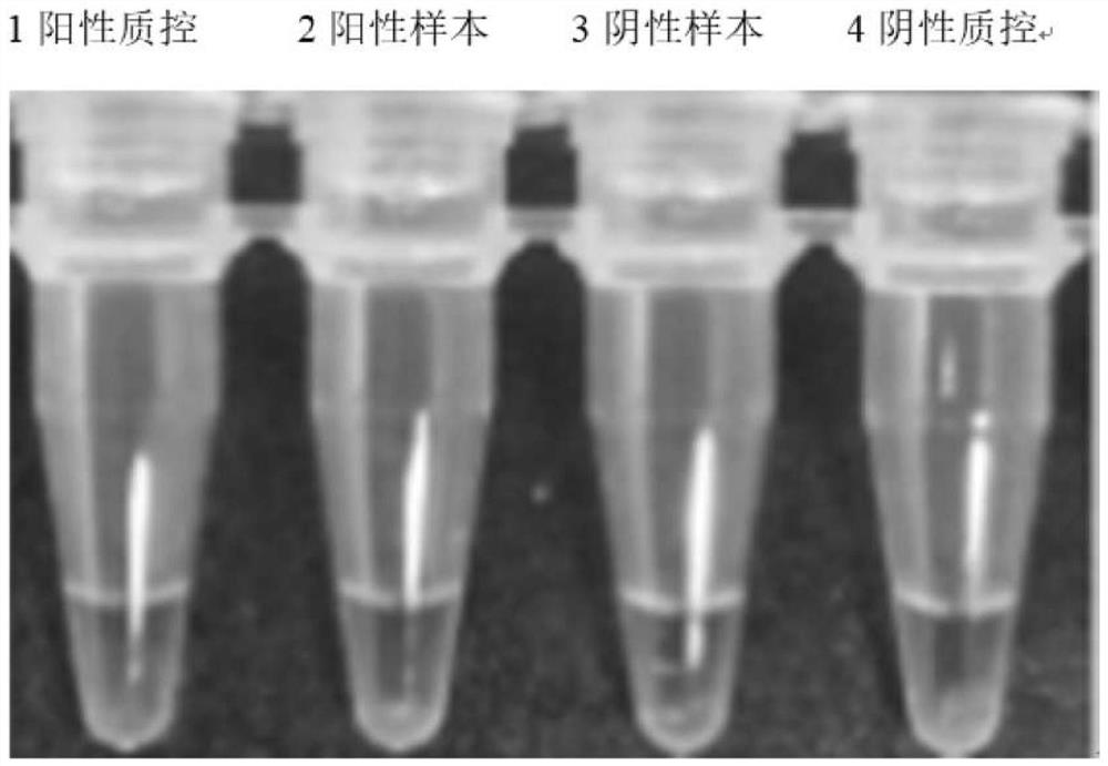 A closed sars-cov-2 isothermal amplification nucleic acid detection kit