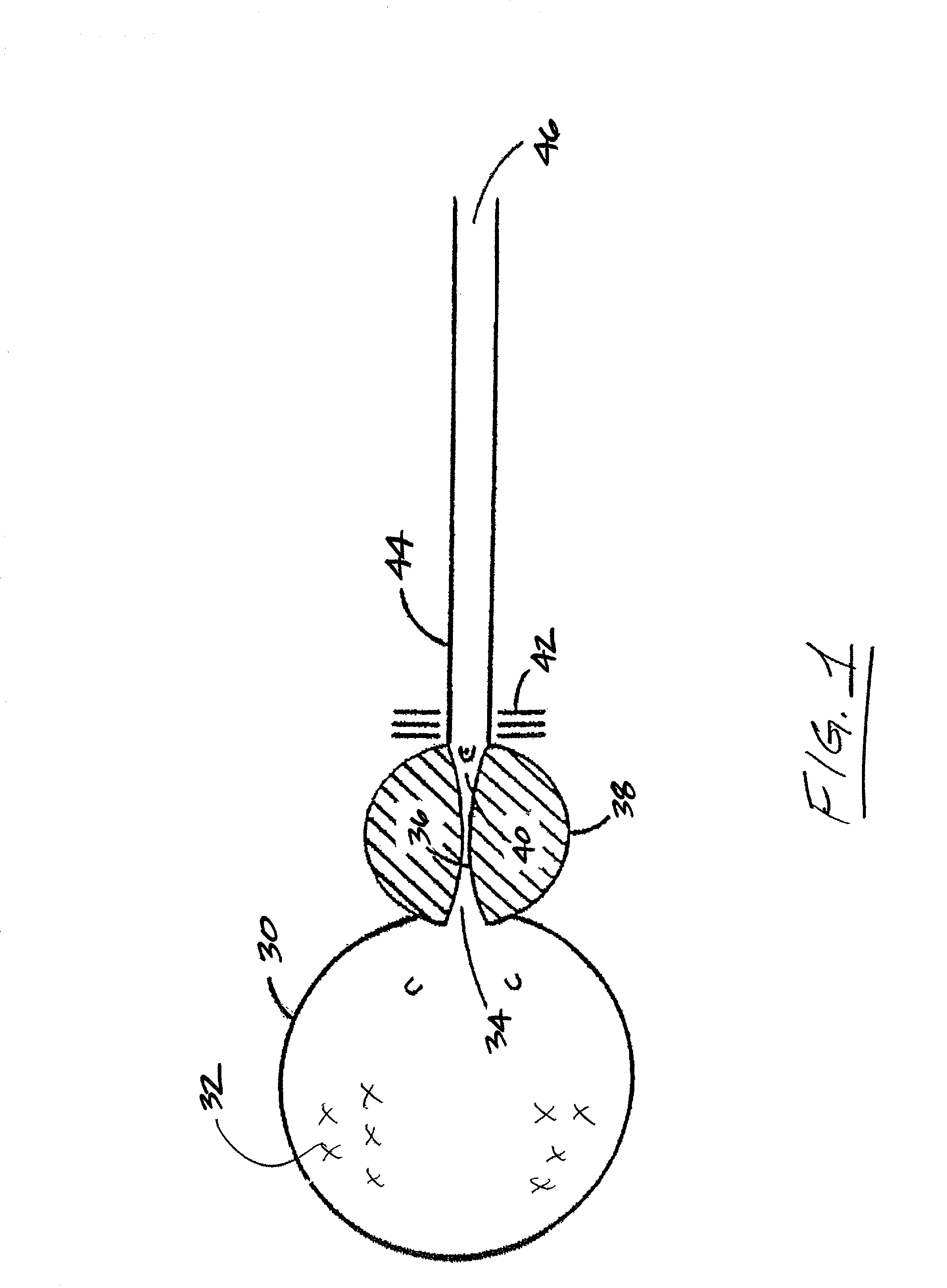 Endourethral device  and method