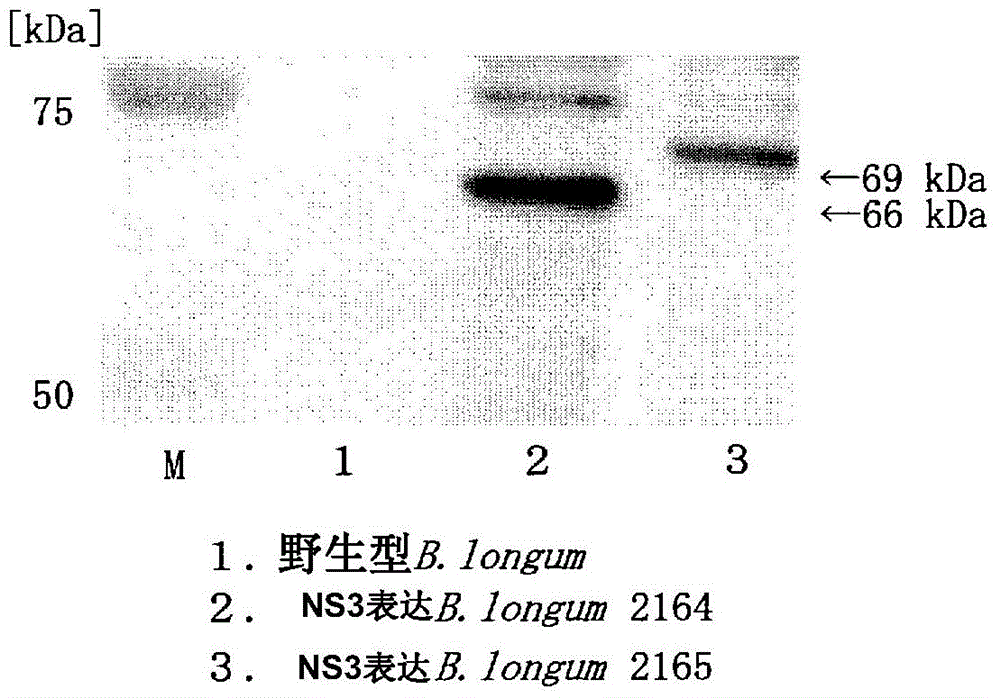 Immunogenic polypeptide surface layer-expressing bifidobacterium