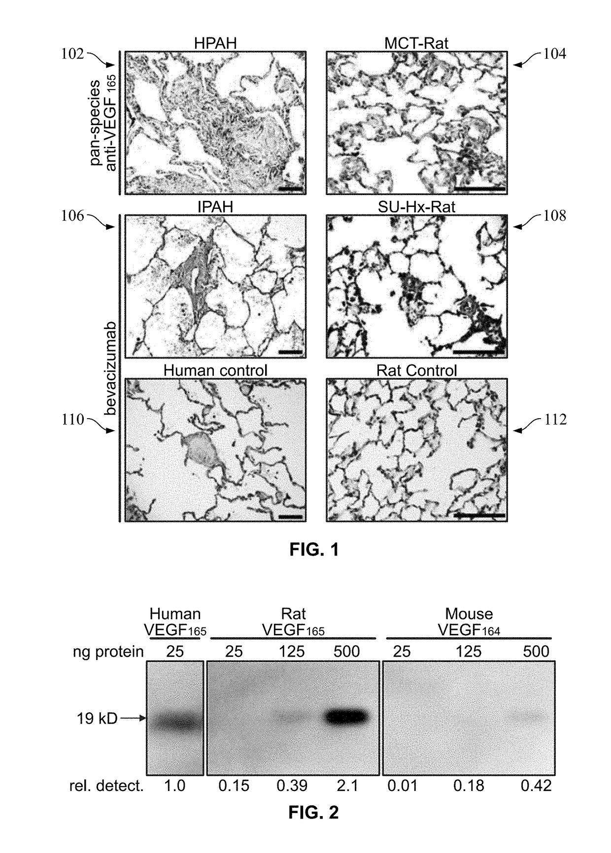 Imaging probe for angiogenic activity in pulmonary arterial hypertension