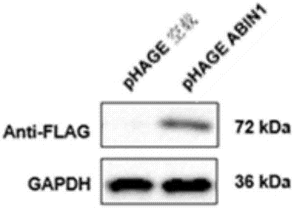 Application of nuclear factor chiB inhibition protein 1 combined with A20 to preparation of medicine for treating fatty livers and related diseases