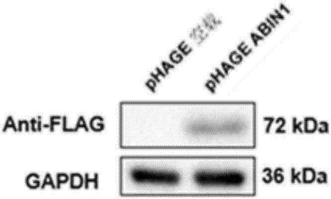 Application of nuclear factor chiB inhibition protein 1 combined with A20 to preparation of medicine for treating fatty livers and related diseases