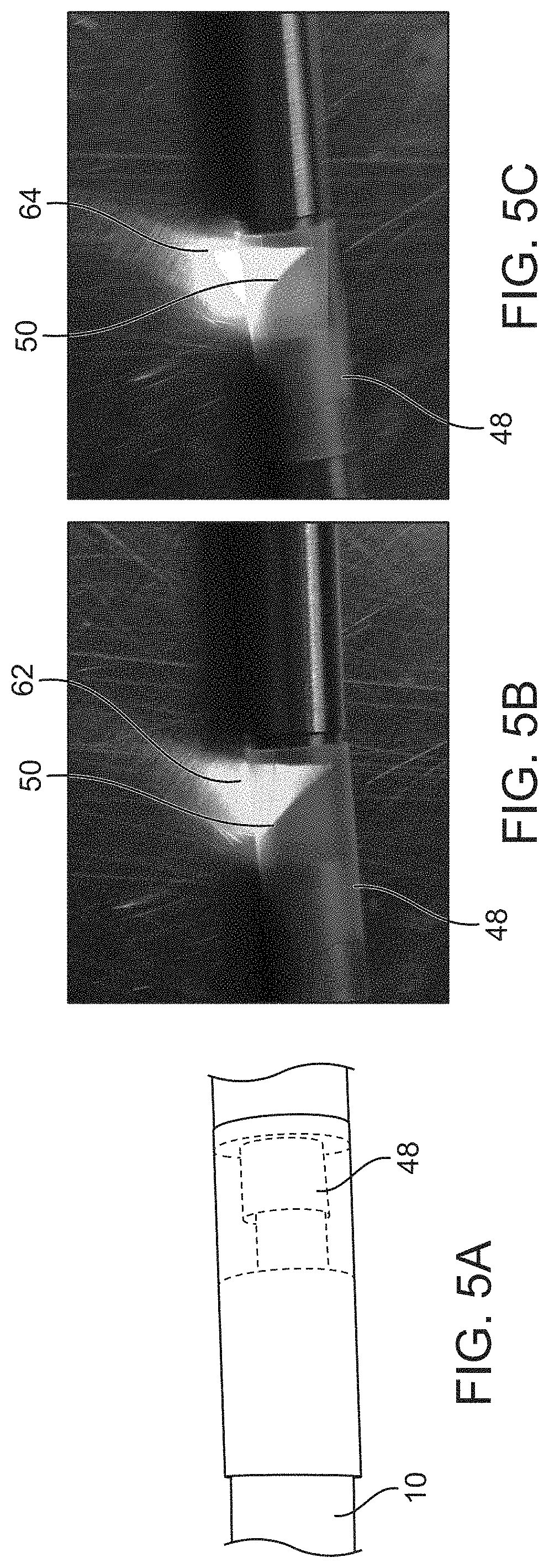 Probe for detecting atherosclerosis