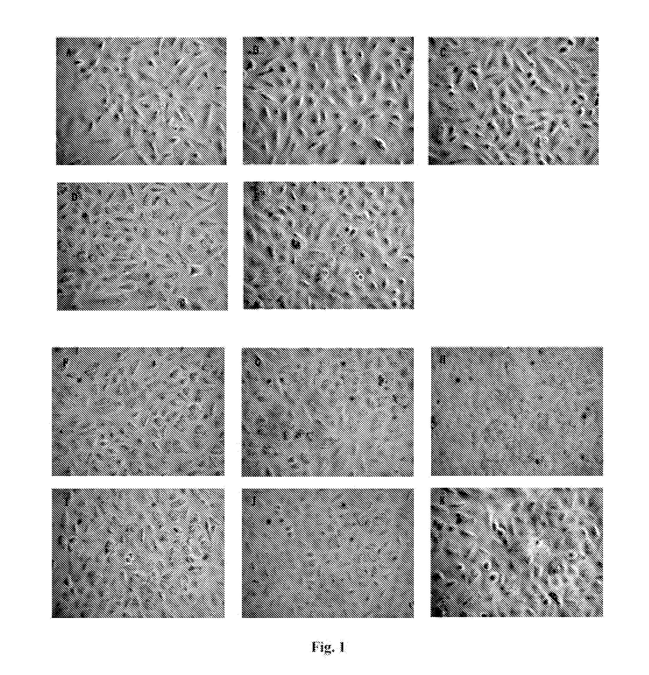 Retinoid Derivative and Pharmaceutical Composition and Use Thereof