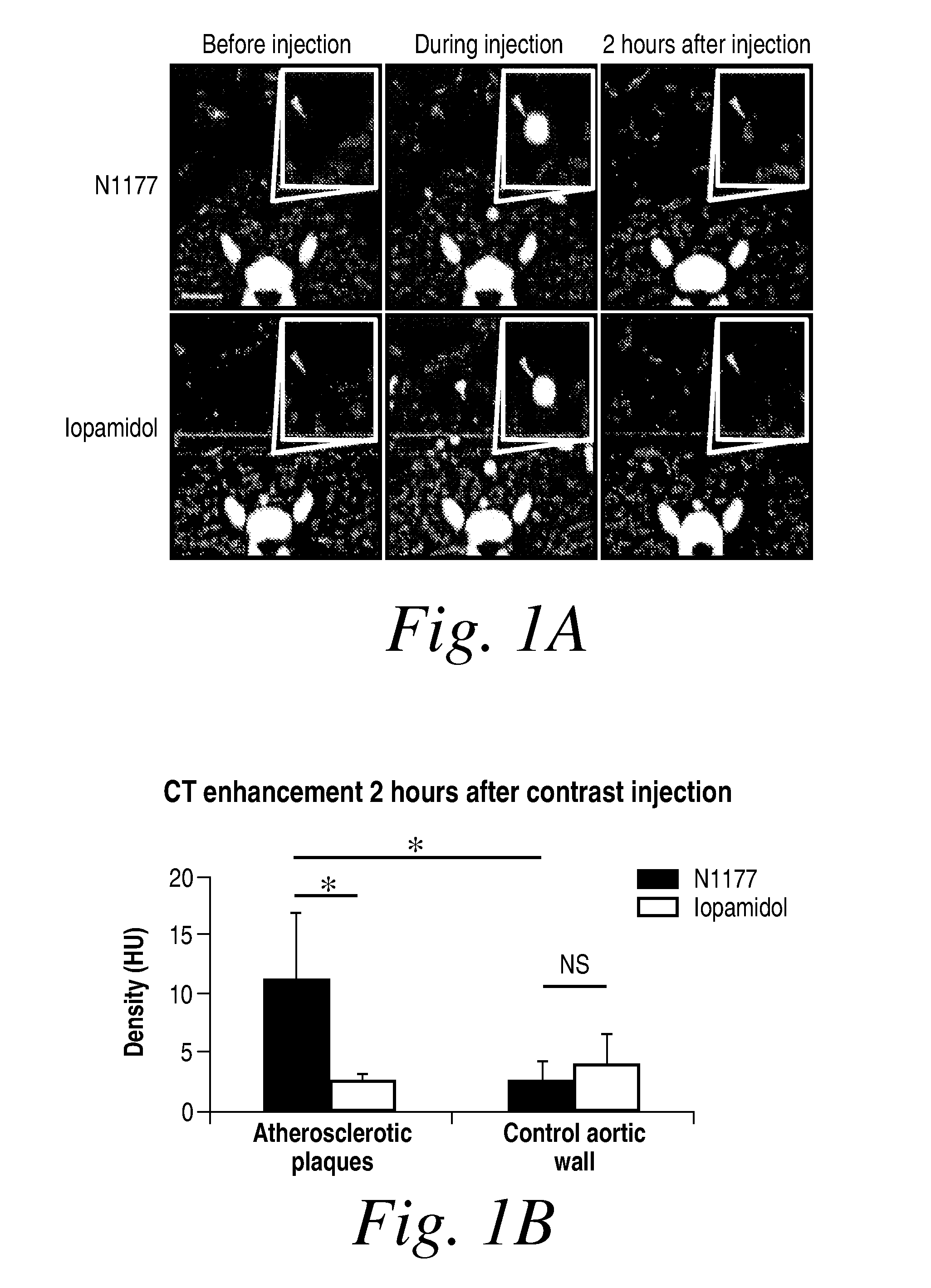 Methods for imaging vascular inflammation using improved nanoparticle contrast agents