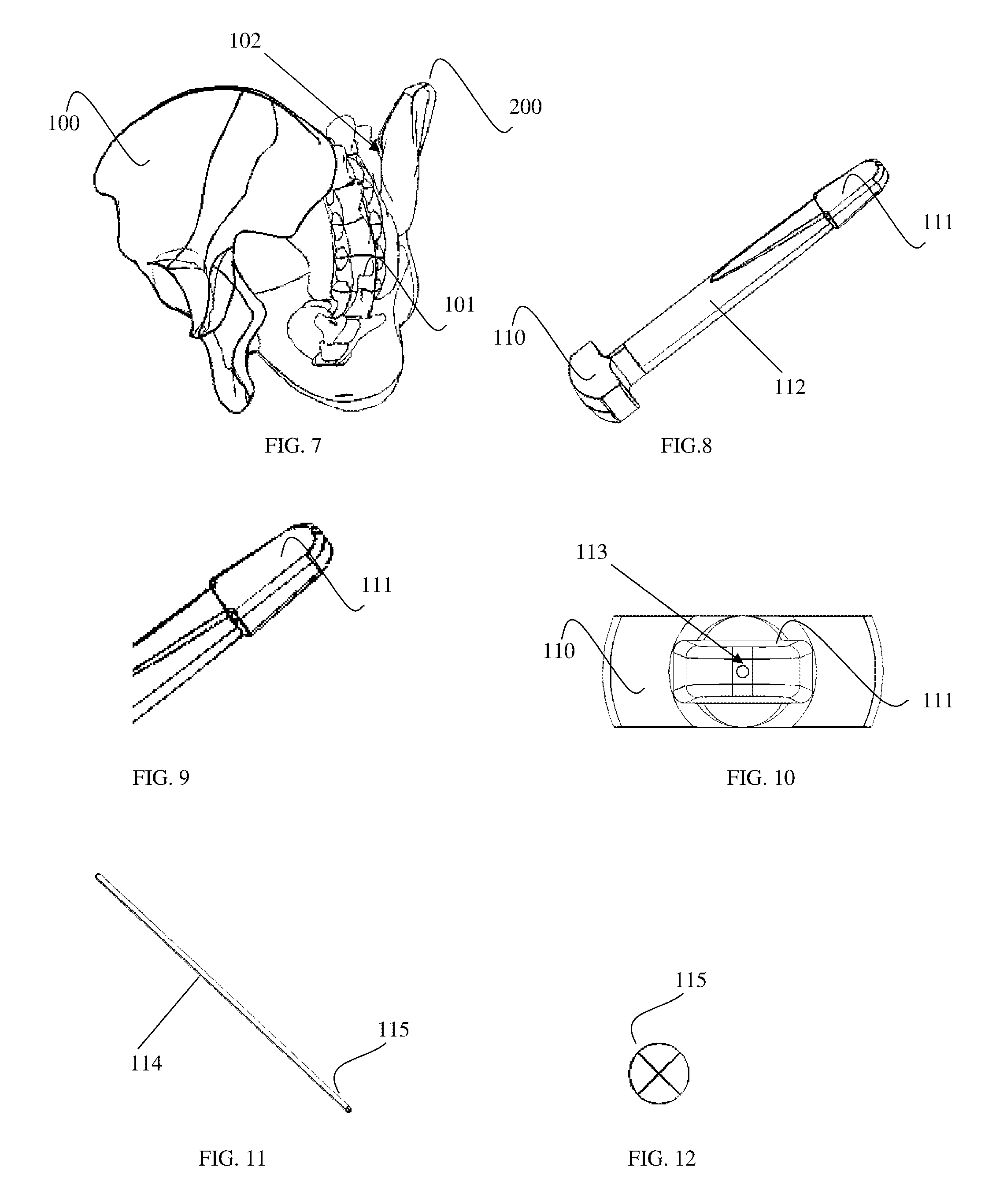 Method and implant system for sacroiliac joint fixation and fusion