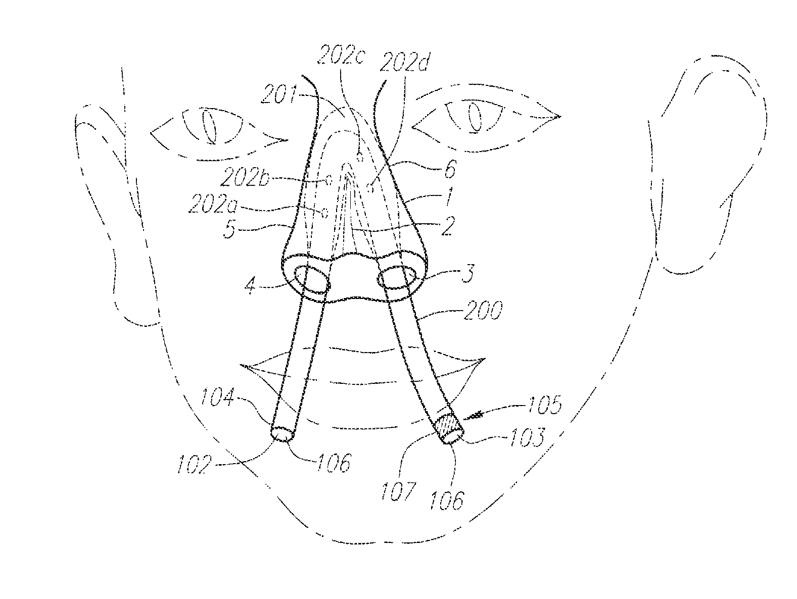 Methods and devices for non-invasive cerebral and systemic cooling via the nasal cavity