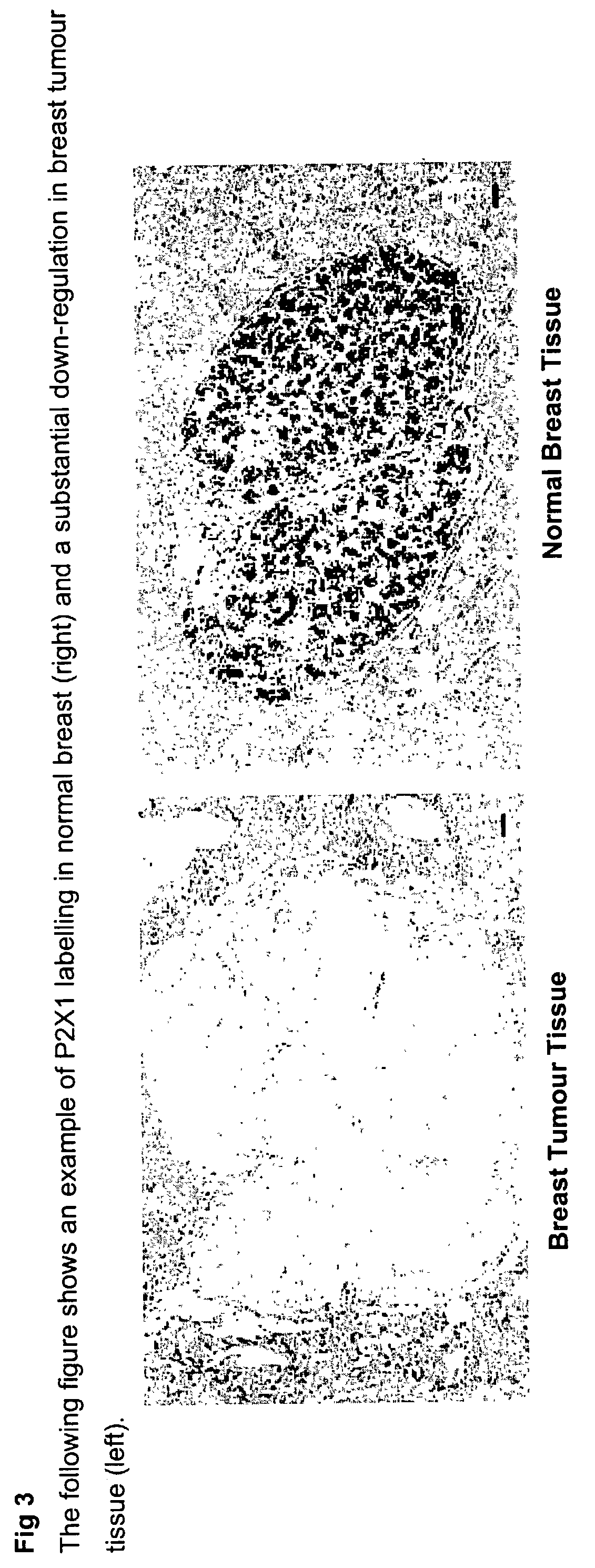 Method for identifying pre-neoplastic and/or neoplastic states in mammals